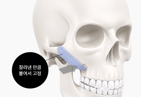 잘라낸 만큼 붙여서 고정